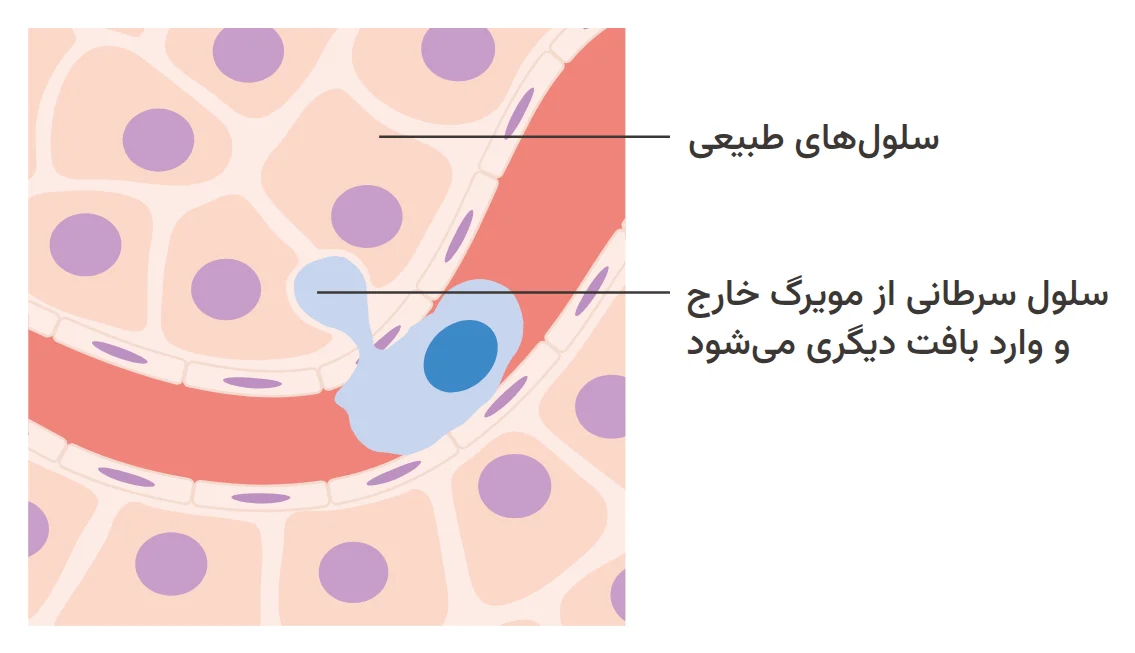 Diagram of a cancer cell leaving a capillary and entering another tissue