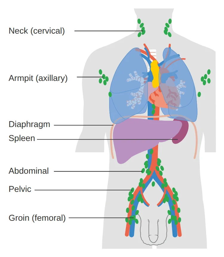 Diagram of the lymph node areas where lymphoma most often develops