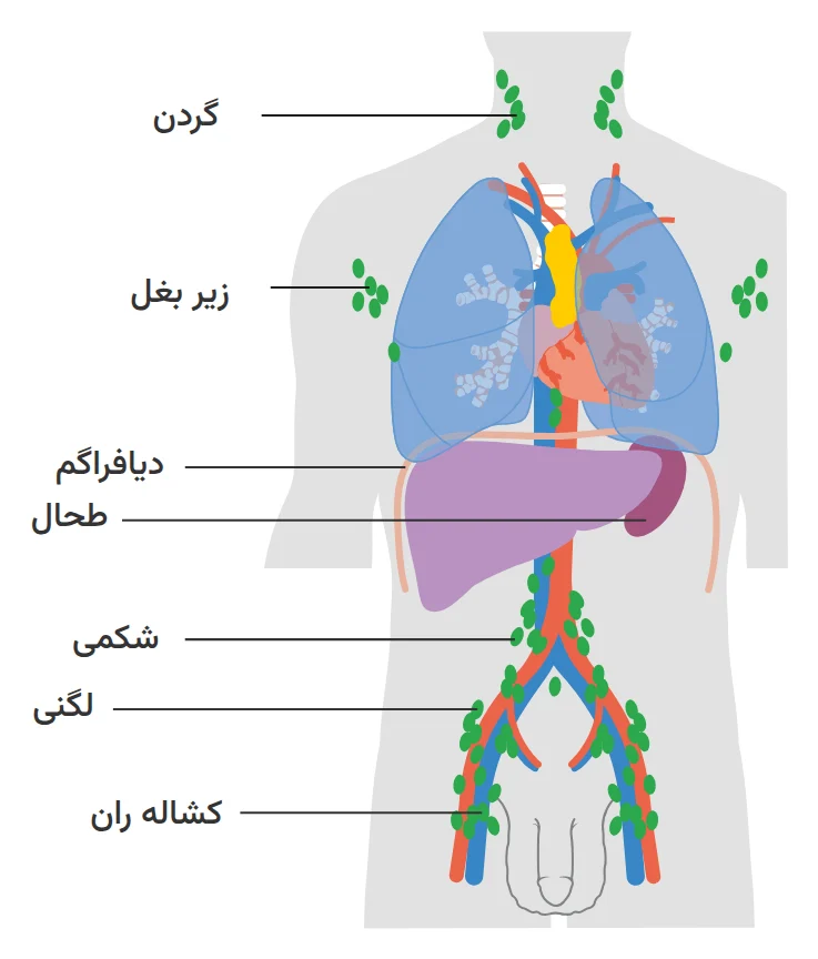 نمودار مناطق غدد لنفاوی که لنفوم بیشتر در آنها ایجاد میشود